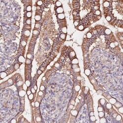 FLVCR Antibody, Novus Biologicals 0.1mL; Unlabeled:Antibodies, Polyclonal